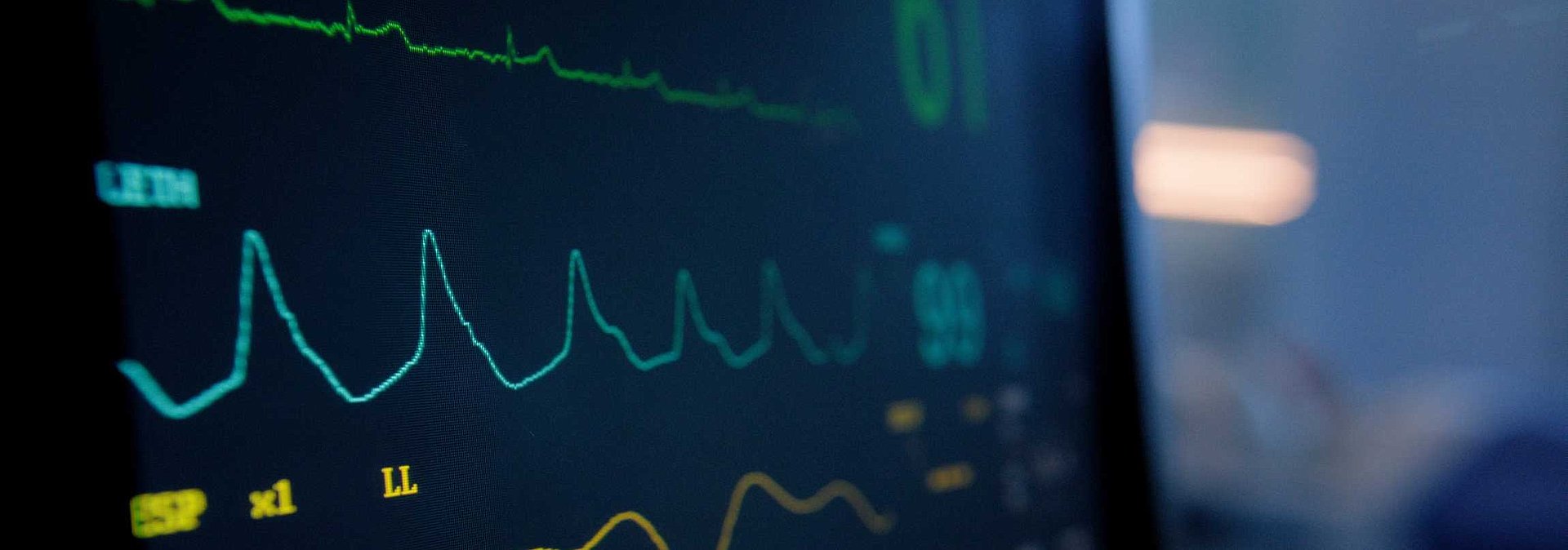 Detailaufnahme eines Monitors für die Rhythmologie